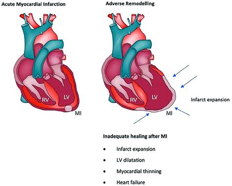 lv effect|Physiology, Left Ventricular Function .